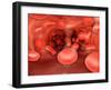 Microscopic View of Red Blood Cells Flowing Inside Lungs-null-Framed Art Print