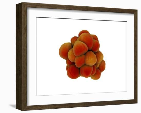 Microscopic View of Tumor-null-Framed Art Print