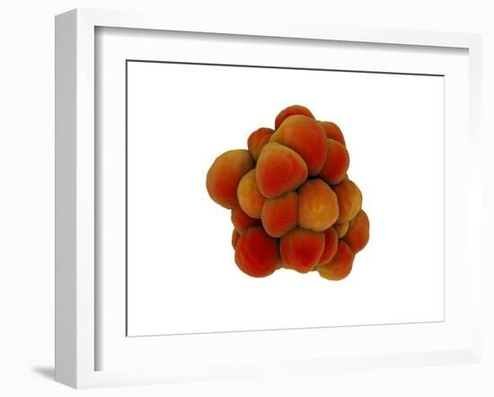 Microscopic View of Tumor-null-Framed Art Print