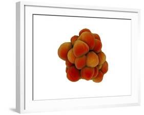 Microscopic View of Tumor-null-Framed Art Print