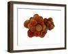 Microscopic View of Tumor-null-Framed Art Print