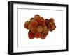 Microscopic View of Tumor-null-Framed Art Print