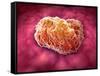 Microscopic View of Tumor-null-Framed Stretched Canvas