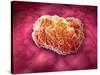 Microscopic View of Tumor-null-Stretched Canvas