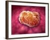 Microscopic View of Tumor-null-Framed Art Print