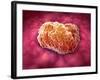 Microscopic View of Tumor-null-Framed Art Print