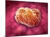 Microscopic View of Tumor-null-Mounted Art Print