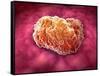 Microscopic View of Tumor-null-Framed Stretched Canvas