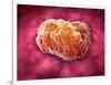 Microscopic View of Tumor-null-Framed Art Print