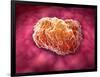 Microscopic View of Tumor-null-Framed Art Print