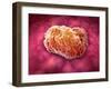 Microscopic View of Tumor-null-Framed Art Print