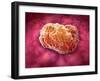 Microscopic View of Tumor-null-Framed Art Print