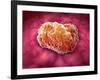 Microscopic View of Tumor-null-Framed Art Print