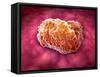 Microscopic View of Tumor-null-Framed Stretched Canvas