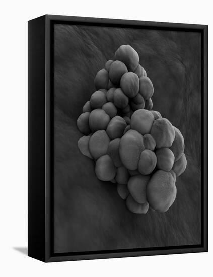 Microscopic View of Tumor-null-Framed Stretched Canvas