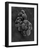 Microscopic View of Tumor-null-Framed Art Print