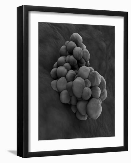 Microscopic View of Tumor-null-Framed Art Print