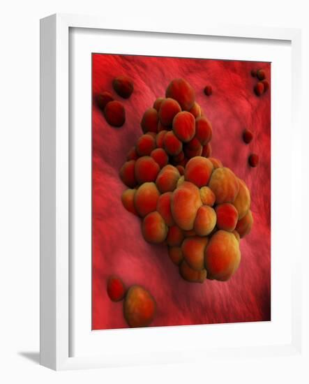 Microscopic View of Tumor-null-Framed Art Print