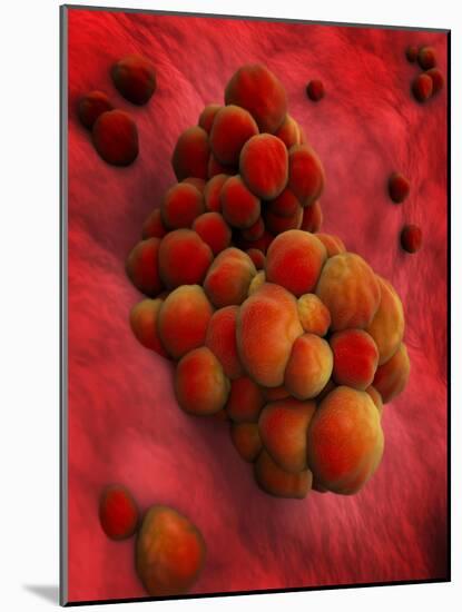 Microscopic View of Tumor-null-Mounted Art Print