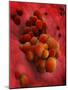 Microscopic View of Tumor-null-Mounted Art Print