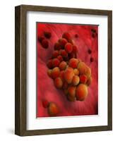 Microscopic View of Tumor-null-Framed Art Print