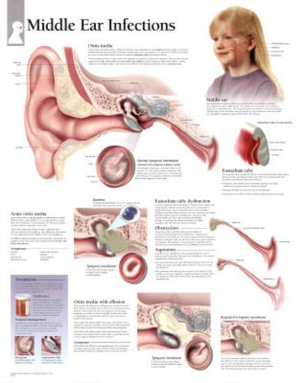 Poster, , large