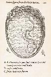 Heart Disease, 18th Century-Middle Temple Library-Photographic Print