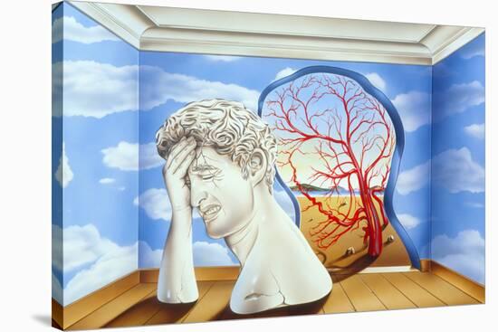 Migraine-John Bavosi-Stretched Canvas