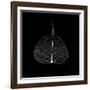 Minimalism in Black I-Patricia Pinto-Framed Art Print