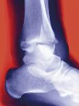 Knee Joint, Side View, MRI Scan-Miriam Maslo-Photographic Print