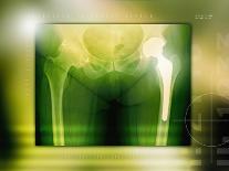 Normal Spine, X-ray-Miriam Maslo-Photographic Print