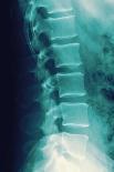 Normal Spine, X-ray-Miriam Maslo-Photographic Print