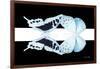 Miss Butterfly Duo Cloanthaea - X-Ray B&W Edition-Philippe Hugonnard-Framed Photographic Print