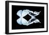 Miss Butterfly Duo Euploanthus - X-Ray Black Edition-Philippe Hugonnard-Framed Photographic Print