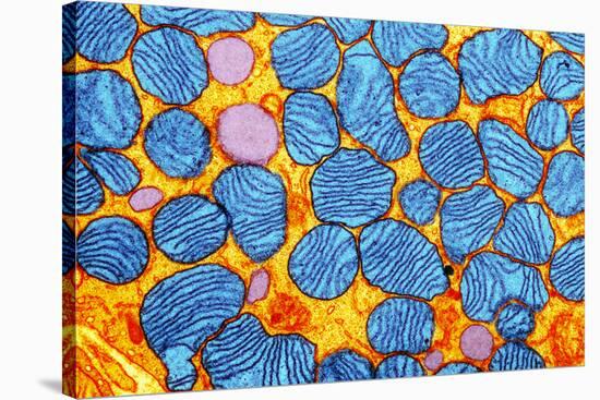 Mitochondria, TEM-null-Stretched Canvas