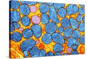 Mitochondria, TEM-null-Stretched Canvas