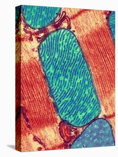 Mitochondrion, TEM-Thomas Deerinck-Stretched Canvas