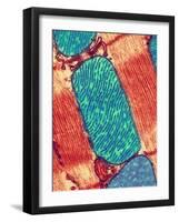 Mitochondrion, TEM-Thomas Deerinck-Framed Photographic Print