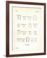 Molars-null-Framed Giclee Print