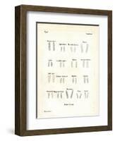 Molars-null-Framed Giclee Print