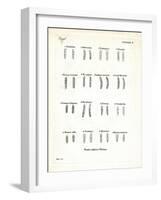 Molars-null-Framed Giclee Print