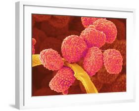 Moss Spores-Micro Discovery-Framed Photographic Print