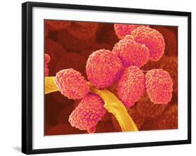 Moss Spores-Micro Discovery-Framed Photographic Print