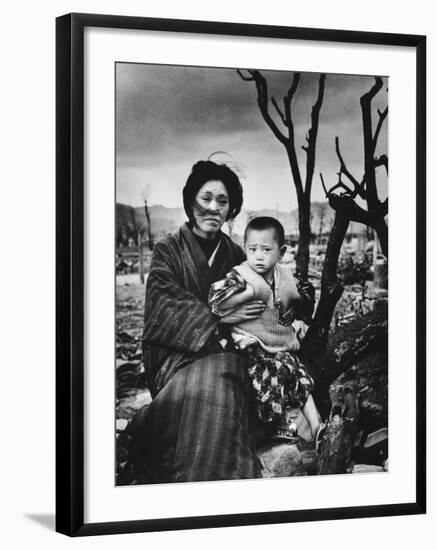 Mother and Child in Hiroshima, Four Months After the Atomic Bomb Dropped-Alfred Eisenstaedt-Framed Photographic Print