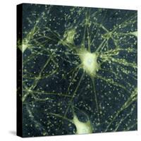 Motor Neurons, Light Micrograph-Steve Gschmeissner-Stretched Canvas