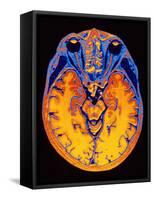 MRI Brain Scan-PASIEKA-Framed Stretched Canvas