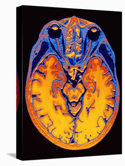 MRI Brain Scan-PASIEKA-Stretched Canvas