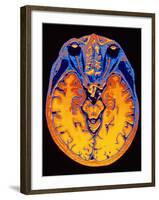 MRI Brain Scan-PASIEKA-Framed Photographic Print