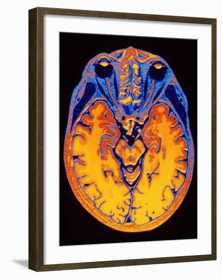 MRI Brain Scan-PASIEKA-Framed Photographic Print