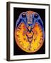 MRI Brain Scan-PASIEKA-Framed Photographic Print